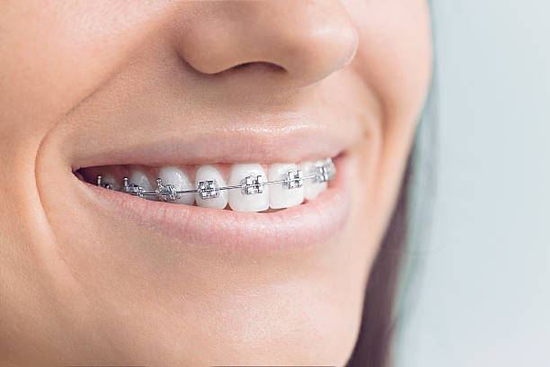 Best Teeth Whitening  in Allegan, MI